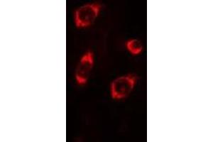 ABIN6275244 staining COLO205 cells by IF/ICC. (MRPL4 antibody  (Internal Region))