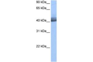 Western Blotting (WB) image for anti-RNA Binding Motif Protein 4 (RBM4) antibody (ABIN2462133)