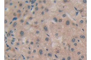 Detection of RSPO1 in Human Liver Tissue using Polyclonal Antibody to R-Spondin 1 (RSPO1) (RSPO1 antibody  (AA 21-135))