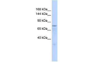 WB Suggested Anti-ZFP62 Antibody Titration:  0. (Zinc Finger Protein 62 (ZFP62) (Middle Region) antibody)