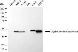 anti-Glycine Amidinotransferase (L-Arginine:glycine Amidinotransferase) (GATM) antibody
