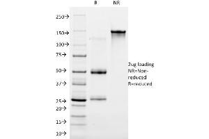 SDS-PAGE Analysis Purified Cytokeratin 16 Mouse Monoclonal Antibody (LL025). (KRT16 antibody  (C-Term))