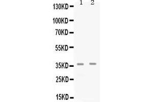 Western blot analysis of Cdk6 expression in rat pancreas extract ( Lane 1) and K562 whole cell lysates ( Lane 2). (CDK6 antibody  (N-Term))