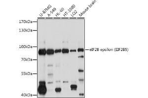 Western blot analysis of extracts of various cell lines, using eIF2B epsilon (eIF2B epsilon (EIF2B5)) antibody (ABIN6130359, ABIN6140041, ABIN6140042 and ABIN6214448) at 1:1000 dilution. (EIF2B5 antibody  (AA 442-721))