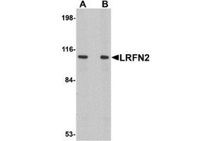 Western Blotting (WB) image for anti-Leucine Rich Repeat and Fibronectin Type III Domain Containing 2 (LRFN2) (C-Term) antibody (ABIN1030490) (LRFN2 antibody  (C-Term))