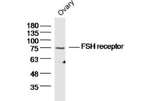 Mouse ovary lysates probed with FSH Receptor Polyclonal Antibody  at 1:300 overnight at 4°C followed by a conjugated secondary antibody for 60 minutes at 37°C.