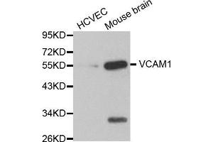 Western blot analysis of extracts of various cell lines, using VCAM1 antibody. (VCAM1 antibody  (AA 300-400))