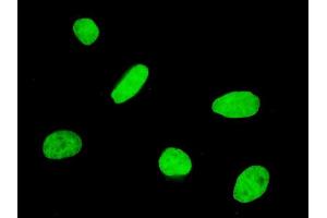 Immunofluorescence of monoclonal antibody to FOXQ1 on HeLa cell. (FOXQ1 antibody  (AA 110-219))