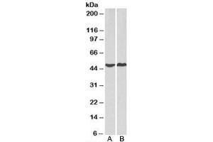 Western blot testing of human A) HeLa and B) MCF7 cell lysate with PRKACA antibody at 2ug/ml. (PRKACA antibody)