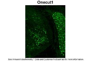 Immunohistochemistry (IHC) image for anti-One Cut Homeobox 1 (ONECUT1) (C-Term) antibody (ABIN2777516) (ONECUT1 antibody  (C-Term))