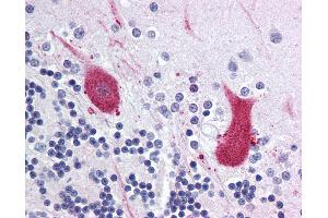 Anti-MARK1 antibody IHC of human brain, cerebellum. (MARK1 antibody  (Internal Region))