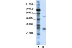 Western Blotting (WB) image for anti-Leucine Rich Repeat Containing 14 (LRRC14) antibody (ABIN2461029) (LRRC14 antibody)