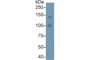 Detection of PLCb4 in Human A549 cell lysate using Polyclonal Antibody to Phospholipase C Beta 4 (PLCb4) (Phospholipase C beta 4 antibody  (AA 2-250))