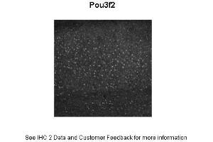 Sample Type :  Mouse adult cortex  Primary Antibody Dilution :  1:1000  Secondary Antibody :  Donkey anti rabbit IgG Alexa 594  Secondary Antibody Dilution :  1:1000  Gene Name :  POU3F2   Submitted by :  Dr. (POU3F2 antibody  (Middle Region))