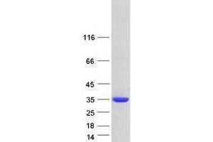 Western Blotting (WB) image for Nitrilase 1 (NIT1) (Transcript Variant 3) protein (Myc-DYKDDDDK Tag) (ABIN2727333)