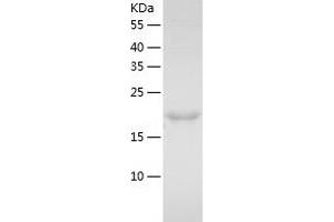 Western Blotting (WB) image for Signal Transducing Adaptor Molecule (SH3 Domain and ITAM Motif) 2 (STAM2) (AA 1-189) protein (His tag) (ABIN7125099) (STAM2 Protein (AA 1-189) (His tag))