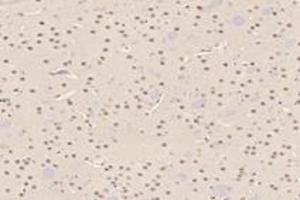 Immunohistochemistry analysis of paraffin-embedded mouse striatum using,RMND5A (ABIN7075401) at dilution of 1: 3000 (RMND5A antibody)