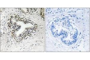Immunohistochemistry analysis of paraffin-embedded human prostate carcinoma tissue, using RPL30 Antibody. (RPL30 antibody  (AA 66-115))