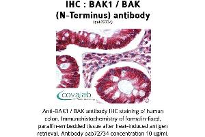 Image no. 1 for anti-BCL2-Antagonist/killer 1 (BAK1) (N-Term) antibody (ABIN1732215) (BAK1 antibody  (N-Term))