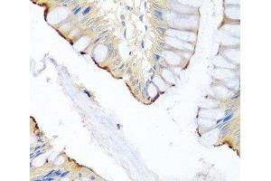 Immunohistochemistry of paraffin-embedded Human colon using LRG1 Polyclonal Antibody at dilution of 1:100 (40x lens). (LRG1 antibody)