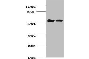 Western blot All lanes: CDK16 antibody at 5 μg/mL Lane 1: Mouse brain tissue Lane 2: Mouse small intestineSecondary Goat polyclonal to rabbit IgG at 1/10000 dilution Predicted band size: 56, 64, 57 kDa Observed band size: 56 kDa (CDK16 antibody  (AA 277-496))