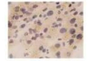 Image no. 2 for anti-Tumor Necrosis Factor alpha (TNF alpha) antibody (ABIN791557) (TNF alpha antibody)