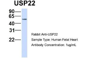 Host: Rabbit   Target Name: USP22   Sample Tissue: Human Fetal Heart  Antibody Dilution: 1. (USP22 antibody  (Middle Region))