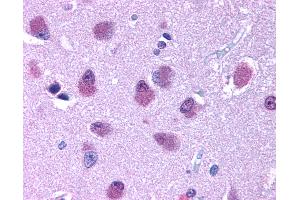 Anti-BRS3 antibody IHC of human brain. (BRS3 antibody  (Cytoplasmic Domain))