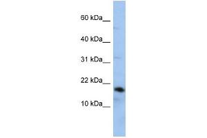 WB Suggested Anti-LCN1 Antibody Titration: 0. (Lipocalin 1 antibody  (Middle Region))