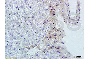Formalin-fixed and paraffin-embedded mouse liver tissue labeled with Rabbit Anti-TNFSF14 Polyclonal Antibody, Unconjugated (ABIN740625) 1:200 followed by conjugation to the secondary antibody and DAB staining