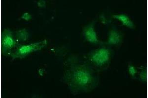 Anti-LIN7B mouse monoclonal antibody (ABIN2453853) immunofluorescent staining of COS7 cells transiently transfected by pCMV6-ENTRY LIN7B (RC205598). (LIN7B antibody)