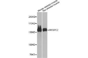 Western blot analysis of extracts of various cell lines, using MYBPC2 antibody (ABIN6291568) at 1:1000 dilution. (MYBPC2 antibody)