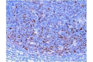 Immunohistochemistry (IHC) image for anti-Checkpoint Kinase 1 (CHEK1) antibody (ABIN487487) (CHEK1 antibody)