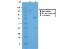 SDS-PAGE analysis of purified, BSA-free recombinant NKX2. (NKX2-1 antibody)