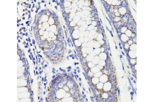Immunohistochemistry of paraffin-embedded Human colon using PDCD10 Polyclonal Antibody at dilution of 1:100 (40x lens). (PDCD10 antibody)