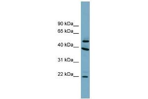 C4ORF20 antibody used at 1 ug/ml to detect target protein. (UFSP2 antibody  (Middle Region))