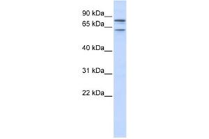 WB Suggested Anti-KCNQ1 Antibody Titration:  0. (KCNQ1 antibody  (N-Term))