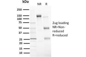 SDS-PAGE Analysis Purified MDM2 Mouse Monoclonal Antibody (MDM2/2414). (MDM2 antibody  (AA 126-254))