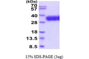 SDS-PAGE (SDS) image for SLAM Family Member 6 (SLAMF6) (AA 22-226) protein (His tag) (ABIN5854757)
