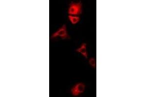 Immunofluorescent analysis of E3BP staining in U2OS cells. (PDHX antibody)