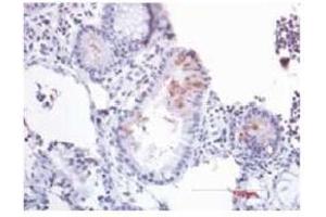Immunohistochemistry (IHC) image for anti-Defensin beta 2 (BD-2) (AA 4-41) antibody (ABIN191997) (beta 2 Defensin antibody  (AA 4-41))