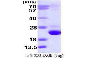 SDS-PAGE (SDS) image for RAB24, Member RAS Oncogene Family (RAB24) (AA 1-203) protein (His tag) (ABIN667586)