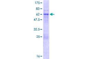 Uroplakin 3B Protein (UPK3B) (AA 1-320) (GST tag)