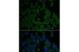 Immunofluorescence analysis of HeLa cells using NF2 Polyclonal Antibody (Merlin antibody)
