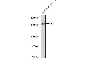 Western blot analysis of extracts of rat small intestine, using ROR2 antibody (ABIN7269889) at 1:1000 dilution. (ROR2 antibody  (AA 300-400))