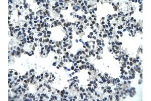 Rabbit Anti-PSIP1 antibody        Paraffin Embedded Tissue:  Human Lung cell   Cellular Data:  Epithelial cells of renal tubule  Antibody Concentration:   4. (PSIP1 antibody  (Middle Region))