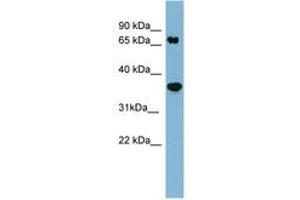 Image no. 1 for anti-Protein Phosphatase 2, Regulatory Subunit A, beta (PPP2R1B) (AA 35-84) antibody (ABIN6741728) (PPP2R1B antibody  (AA 35-84))