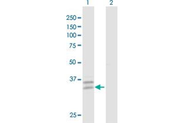 PPT2 antibody  (AA 1-302)
