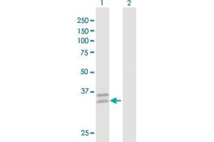 Western Blot analysis of PPT2 expression in transfected 293T cell line by PPT2 MaxPab polyclonal antibody. (PPT2 antibody  (AA 1-302))