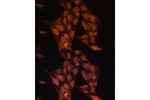 Immunofluorescence analysis of C6 cells using NF2 antibody (ABIN6128275, ABIN6144548, ABIN6144551 and ABIN7101344) at dilution of 1:100. (Merlin antibody  (AA 477-576))